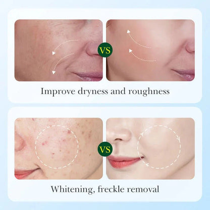 🌿 Sadoer Licorice Root Whitening Skin Care Set ✨